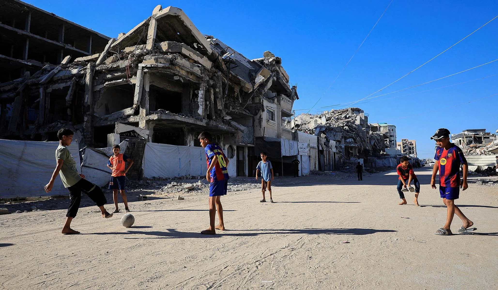 Financial Times Claims Gaza Has the Highest Rate of Child Amputees. Where’s the Evidence? 